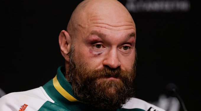 Tyson Fury njofton pensionimin nga boksi