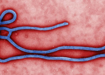 Vdes nga Ebola infermieri në Ugandë