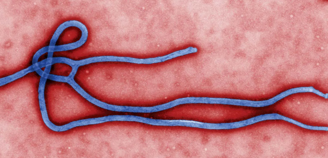 Vdes nga Ebola infermieri në Ugandë