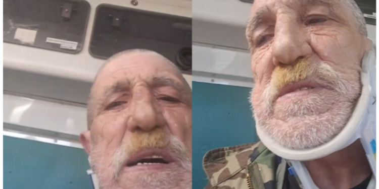 Veterani i UÇK-së pëson aksident, ishte “live” në Facebook