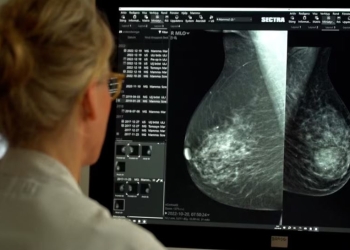 Studimi i ri: Inteligjenca artificiale mund t’i identifikojë gratë që rrezikohen nga kanceri në gji