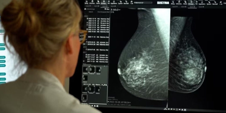 Studimi i ri: Inteligjenca artificiale mund t’i identifikojë gratë që rrezikohen nga kanceri në gji