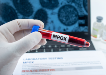 Lija e majmunit në Evropë: Në cilat shtete është zbuluar lloji më i rrezikshëm i virusit?