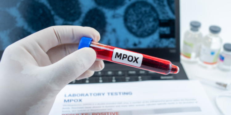 Lija e majmunit në Evropë: Në cilat shtete është zbuluar lloji më i rrezikshëm i virusit?