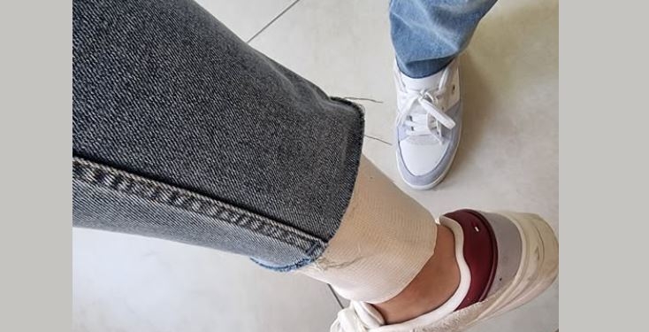 Qytetarja sulmohet nga qeni endacak në Prishtinë, bën thirrje të merren masa urgjente: Jeta jonë është në rrezik