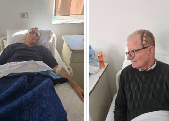 “Dola të mbroja djalin”, i moshuari tregon si u dhunua nga polici dhe miqtë e tij: Më goditën me shkelma
