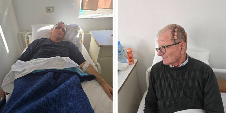 “Dola të mbroja djalin”, i moshuari tregon si u dhunua nga polici dhe miqtë e tij: Më goditën me shkelma