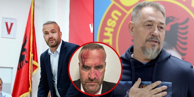 Sulmi në Skenderaj, Prokuroria e Mitrovicës: Po intervistohen dëshmitarë dhe të dyshuar