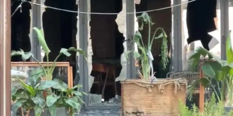 25 vjeçarja që pësoi 85% djegie të trupit dërgohet për trajtim në Turqi